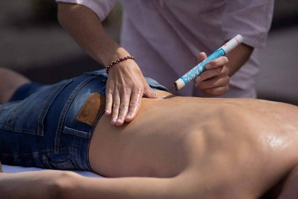 Moxibustión en una espalda