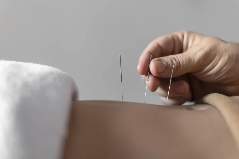 Beneficios físicos y mentales de acudir a un centro de acupuntura